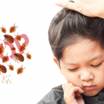 Pidocchi dei capelli: come riconoscerli ed eliminarli