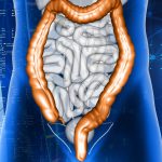 Colon irritabile: i sintomi cui fare attenzione e come agire