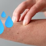 Allergia all’acqua: una situazione rara ma possibile