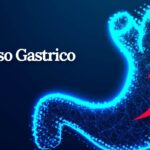 Reflusso gastrico: i sintomi, le cause e l’alimentazione corretta